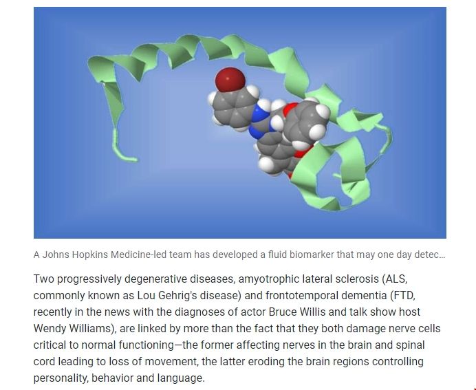 JHU大學發(fā)現ALS和FTD病癥的生物標志物.png