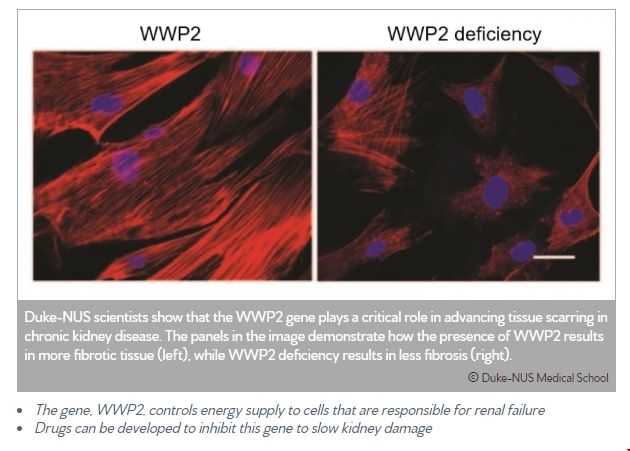 NUS發(fā)現(xiàn)阻止慢性腎病新方法.png
